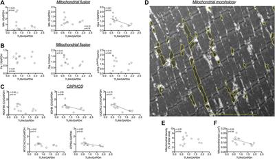 Regulation of mitochondrial morphology and cristae architecture by the TLR4 pathway in human skeletal muscle